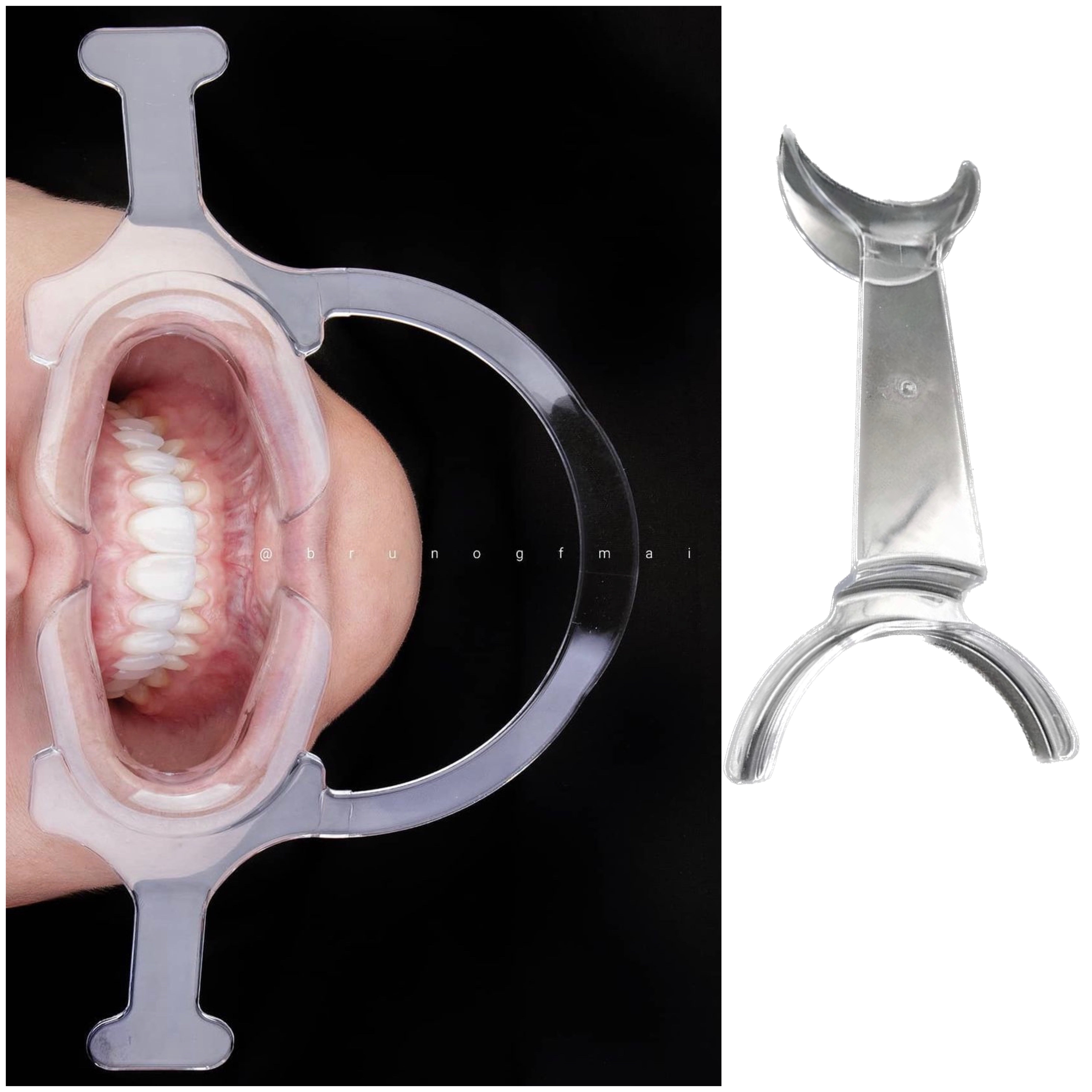 antifog mirror system for dental photographyznj0s